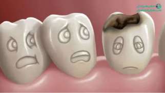 تاثیر اعتیاد بر پوسیدگی دندان