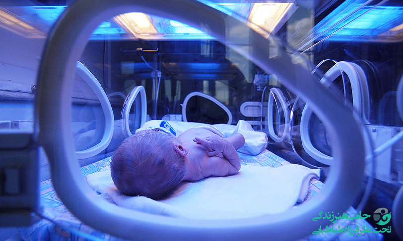 سریع ترین راه درمان زردی نوزاد | از تغذیه با شیر مادر تا تعویض خون
