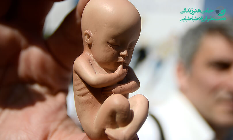 سقط جنین در سه ماهه دوم با قرص