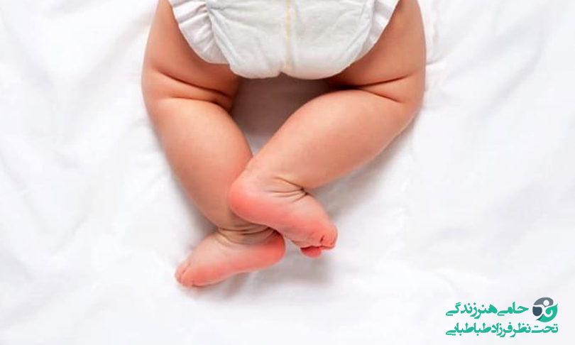 درمان خانگی ادرار سوختگی پای کودک