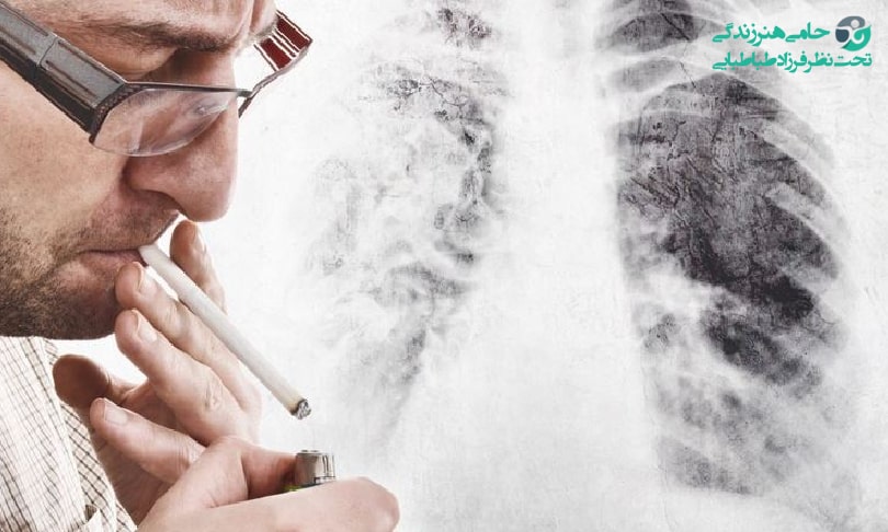 درمان سرفه پس از ترک سیگار