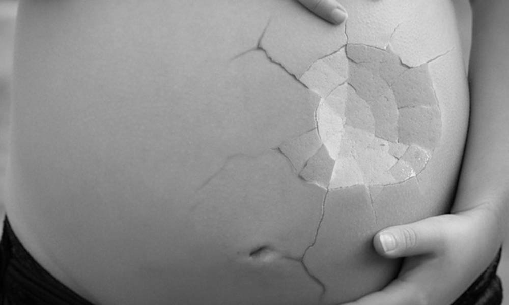 سقط جنین | عوارض و دلایل سقط جنین عمدی و غیر عمدی
