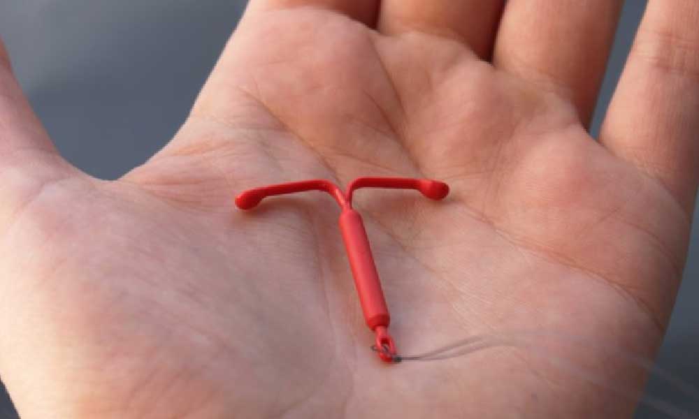 آی یو دی (IUD) | اطلاعات کامل درباره آی‌ یو دی