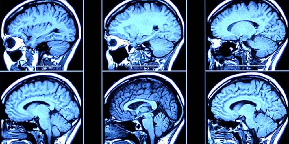 مواد مخدر با ذهن و مغز چه می کند؟