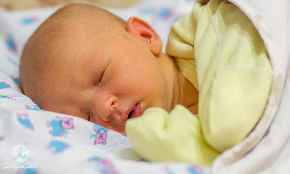 زردی نوزاد | نشانه ها و راه درمان یرقان نوزاد