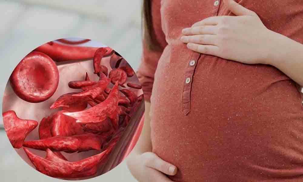 کم خونی در بارداری | علائم، دلایل و درمان کم خونی در دوران بارداری