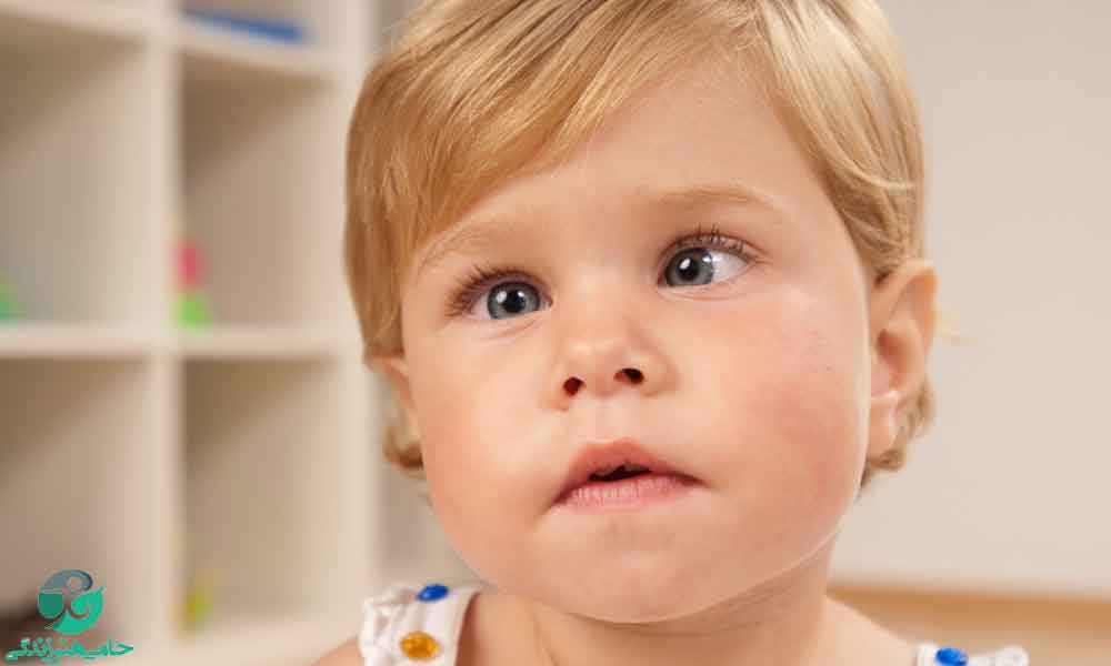 تنبلی چشم در کودکان | روش‌های تشخیص و درمان تنبلی چشم کودکان