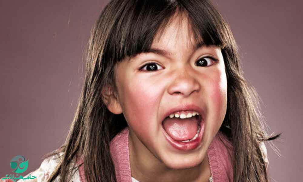 عصبانیت کودکان | علت و راهکارهایی برای کاهش عصبانیت در کودکان