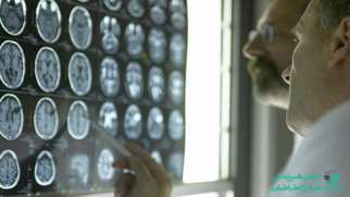 علائم ضربه مغزی | نشانه ها و عوارض آسیب دیدگی مغز