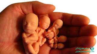 عوارض سقط جنین با قرص | وقتی تصمیم به پایان بارداری می گیرید