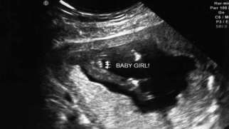 تعیین جنسیت جنین | روش‌های خانگی برای تشخیص جنسیت جنین