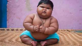 دلایل چاقی کودکان | علل و روش های تعیین چاقی کودک