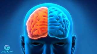 سکته مغزی | علائم، علل، انواع و درمان سکته مغزی