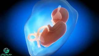 مایع آمنیوتیک | مشکلات مرتبط با مایع آمنیوتیک در دوران بارداری
