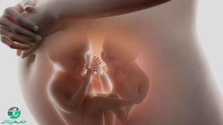 بارداری دوقلو | هر آنچه که باید در مورد بارداری دوقلو بدانید