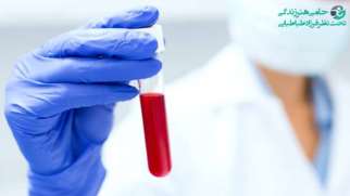 معنی blood urea در آزمایش خون